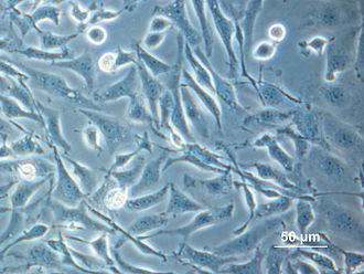 Chinese Hamster overy (CHO) cells