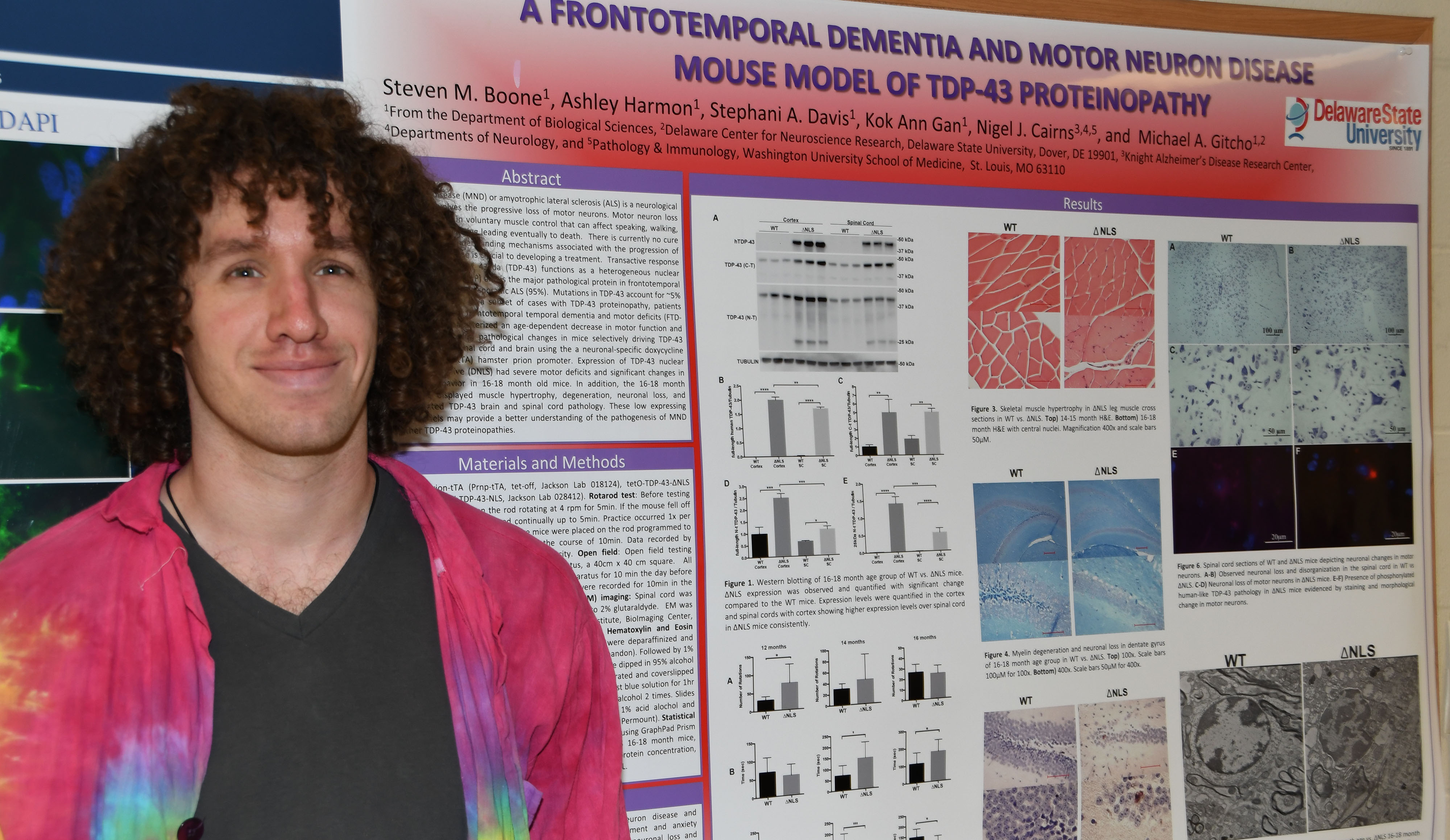 Steven Boone stands alongside a research poster he helped author. The motor neuron disease aspect of the poster is also related to the work he will do for NASA as a research fellow.